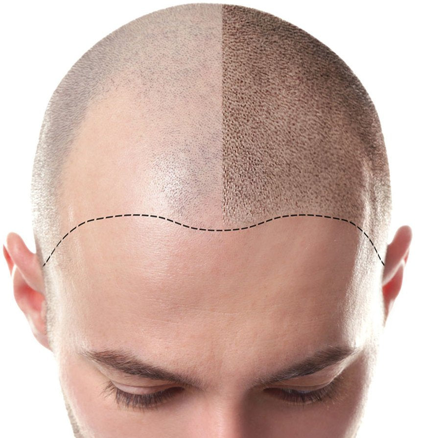 Hanafy X D-Chris DOTX Scalp set
